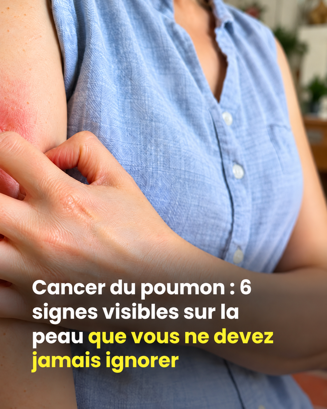 Cancer du poumon : les signaux d'alerte que votre peau peut vous envoyer