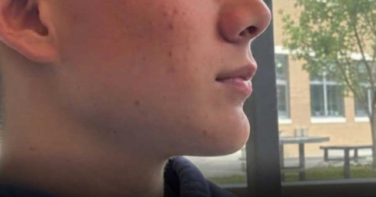 Sam, lycéen autiste : sa mort tragique relance le débat sur l'accompagnement scolaire des élèves vulnérables
