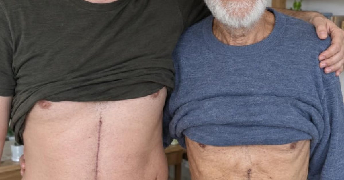 Il donne une partie de son foie à son père : le récit bouleversant d'un don du vivant