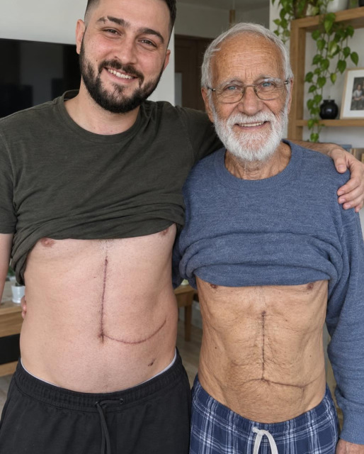 Il donne une partie de son foie à son père : le récit bouleversant d'un don du vivant
