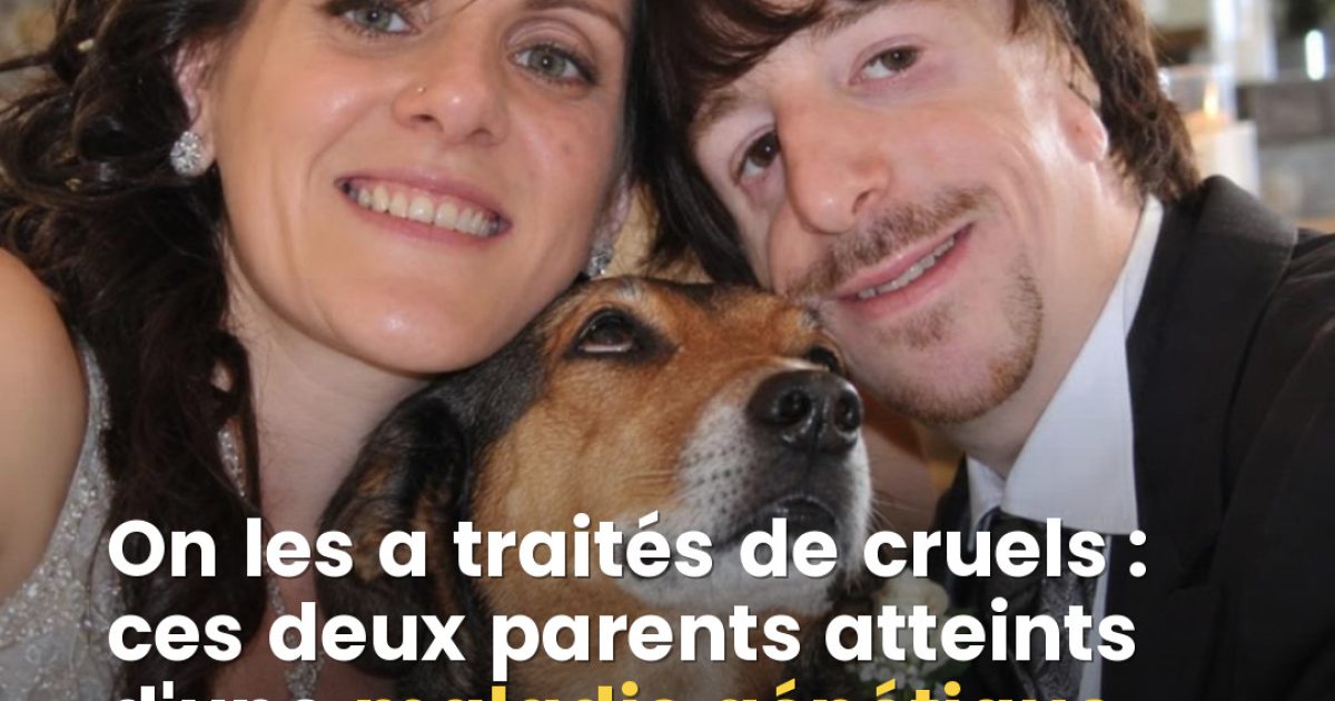 Syndrome de Treacher Collins : ce couple a assumé son choix face au regard des autres