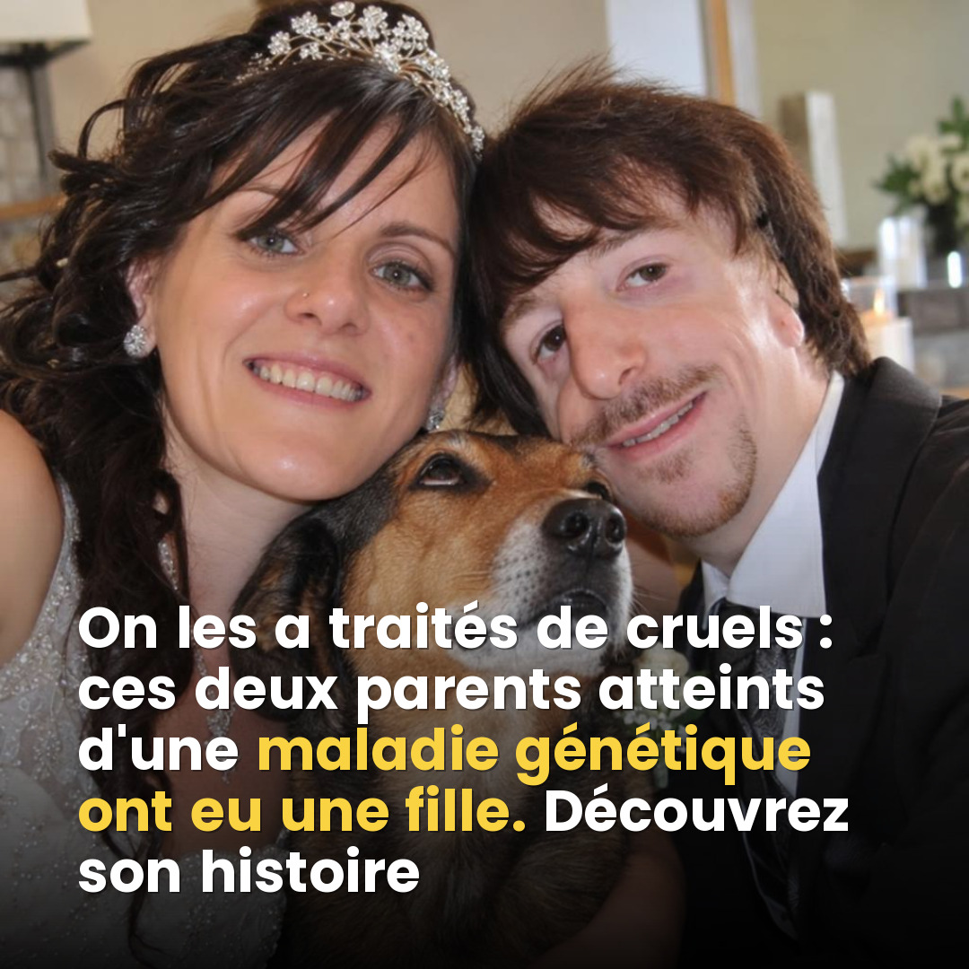Syndrome de Treacher Collins : ce couple a assumé son choix face au regard des autres