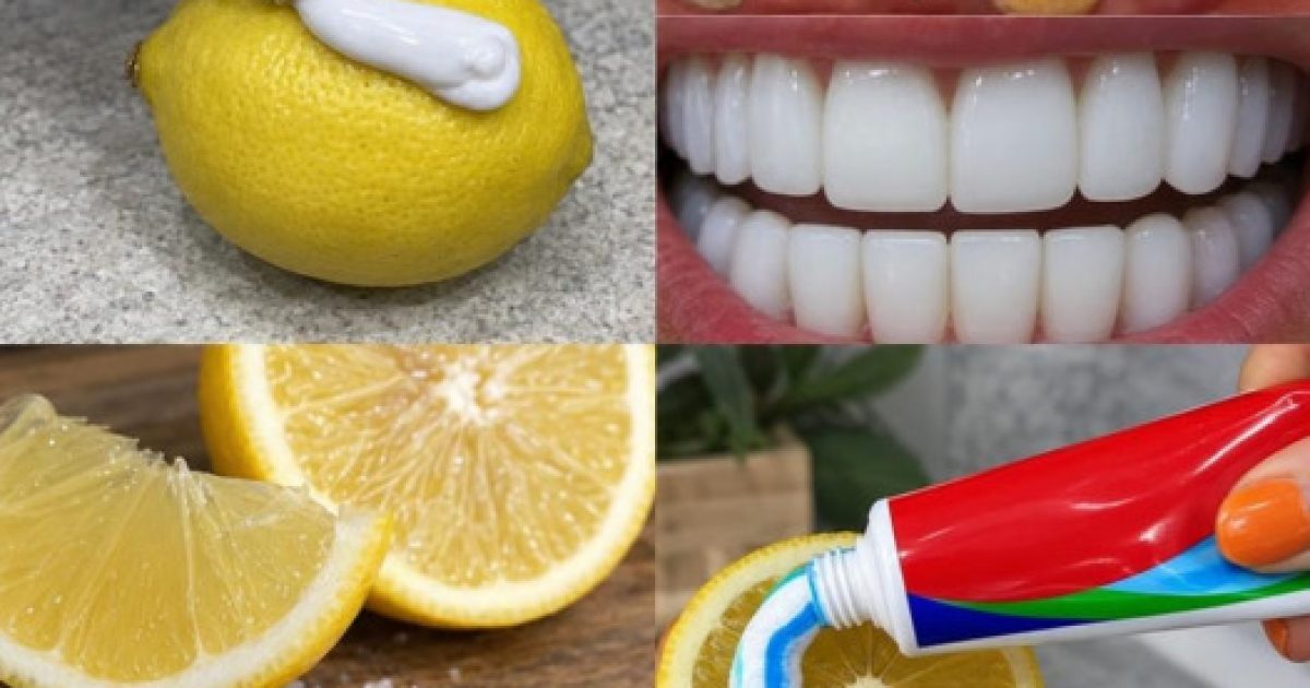 Blanchir ses dents naturellement : les astuces maison qui marchent vraiment