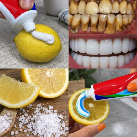 Blanchir ses dents naturellement : les astuces maison qui marchent vraiment