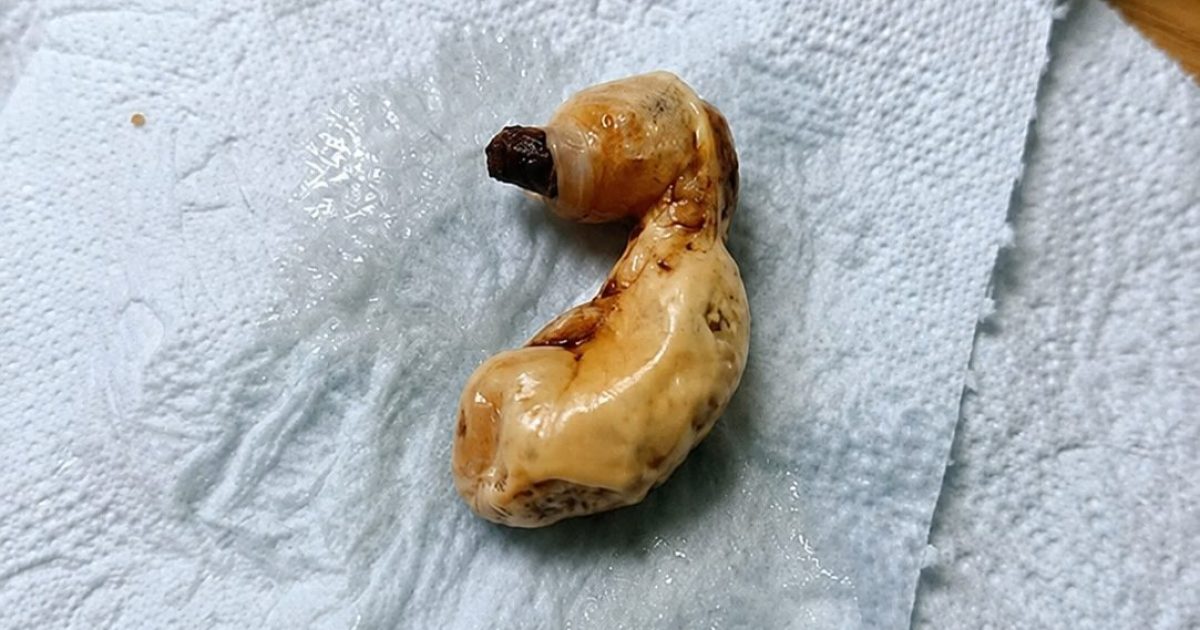 Une coquille de pistache prise pour un insecte : comment notre cerveau nous raconte des histoires