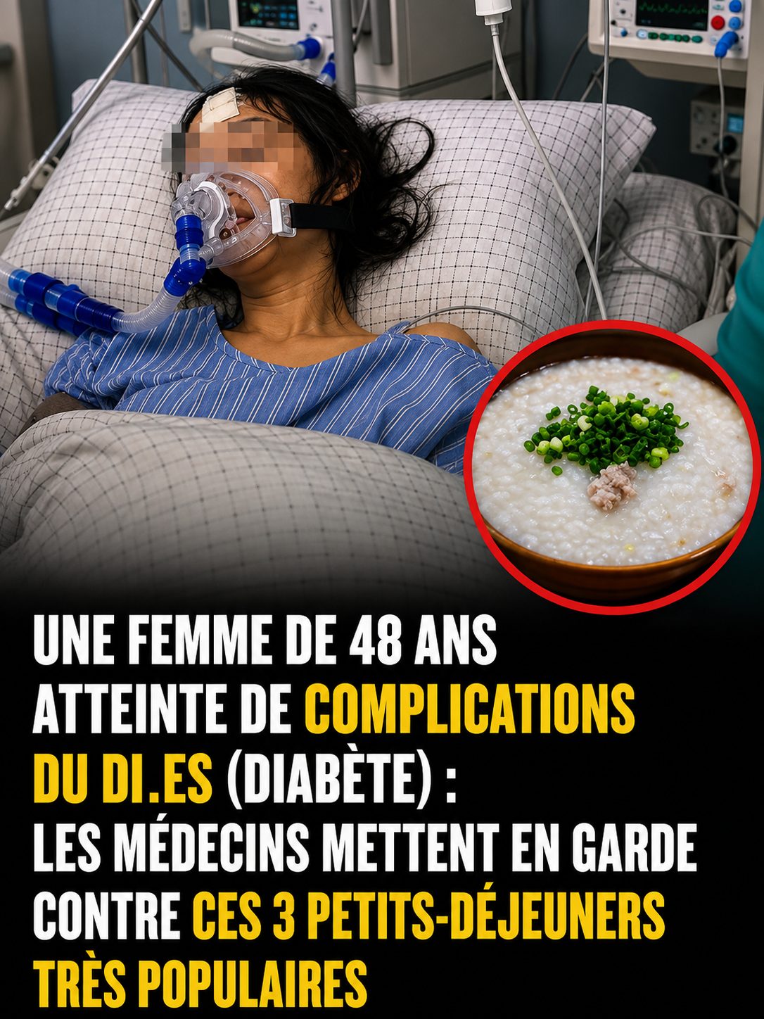 Diabète et petit-déjeuner : ces 3 aliments du matin qui perturbent votre glycémie