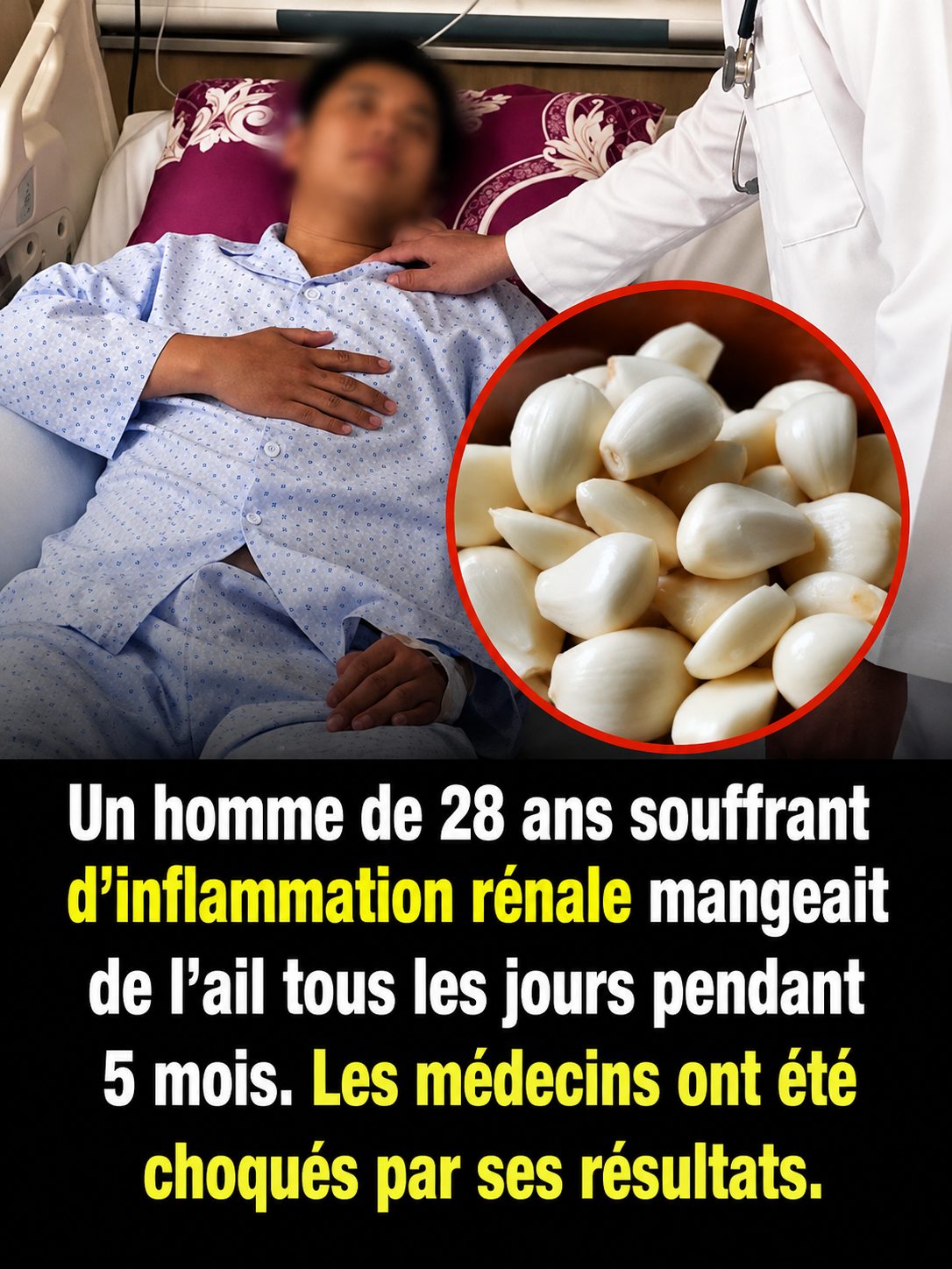 Il mangeait de l'ail cru tous les matins depuis six ans : le diagnostic des médecins l'a bouleversé
