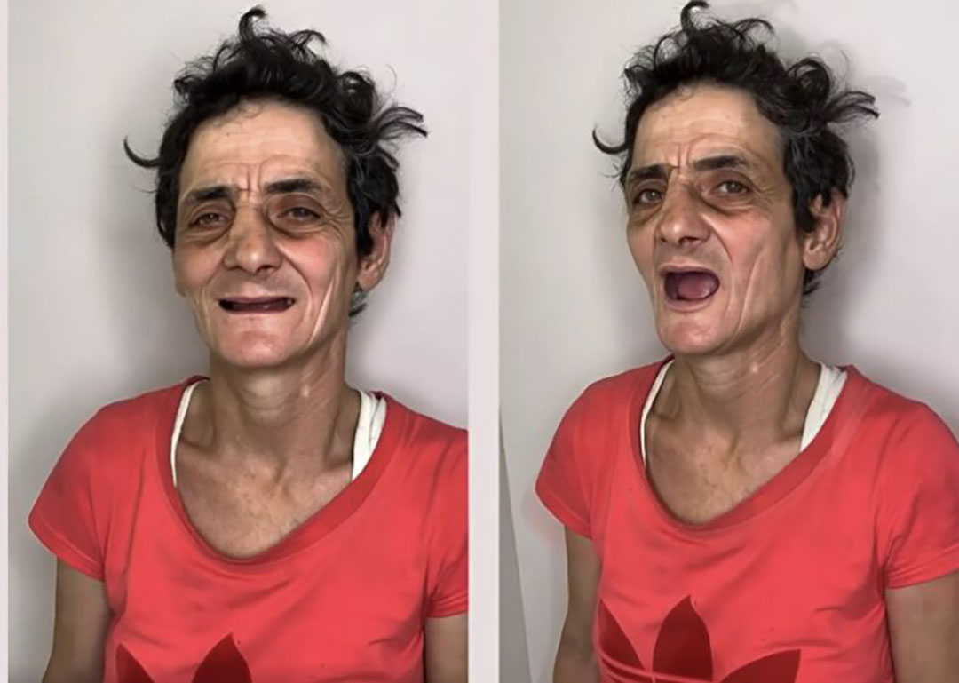Visage d'une femme avant et après une transformation, exprimant un changement profond