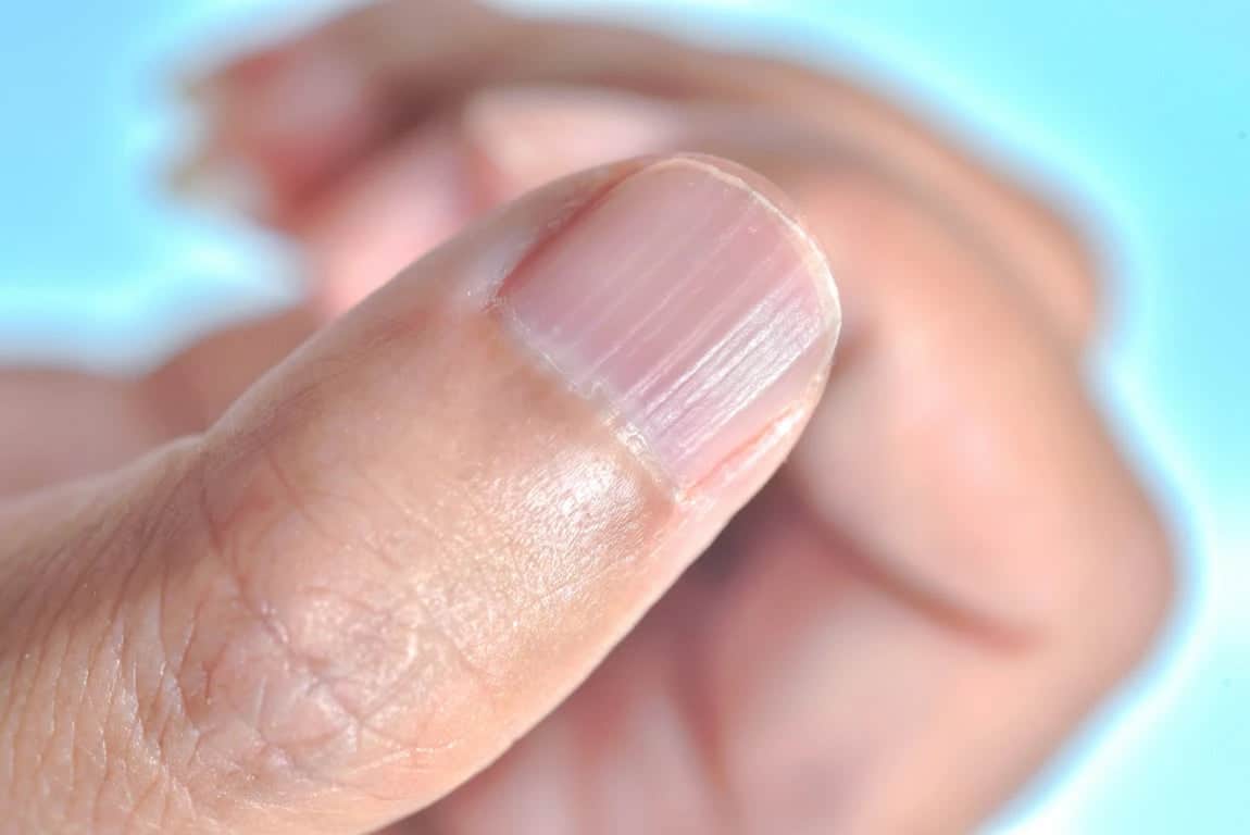 Ongles striés : le message caché derrière ces fines lignes verticales