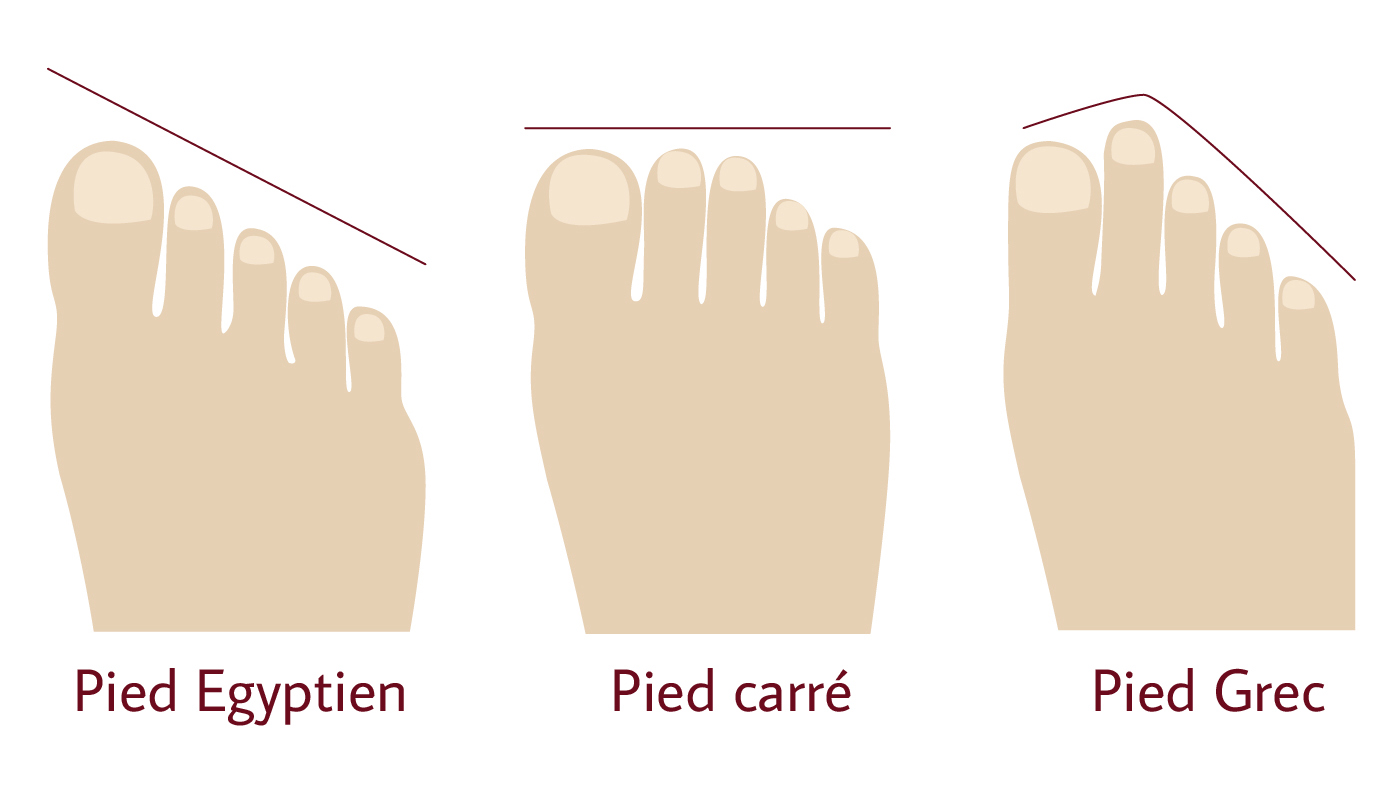 Représentation schématique d'un pied aux orteils alignés, dit pied carré