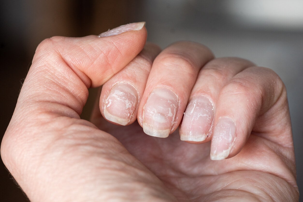 Santé au bout des doigts : que disent vraiment vos ongles striés de votre corps ?