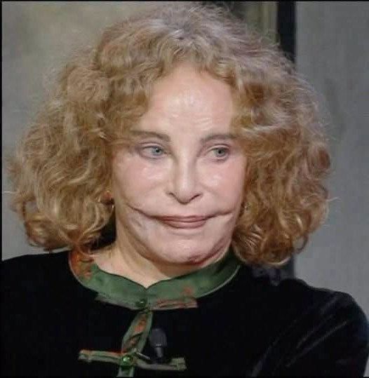 Sydne Rome : l'actrice américaine qui a brillé en Europe avant de surmonter l'incroyable