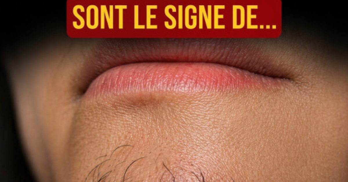 Poils sur le menton chez la femme : les vraies raisons de leur apparition et comment les gérer