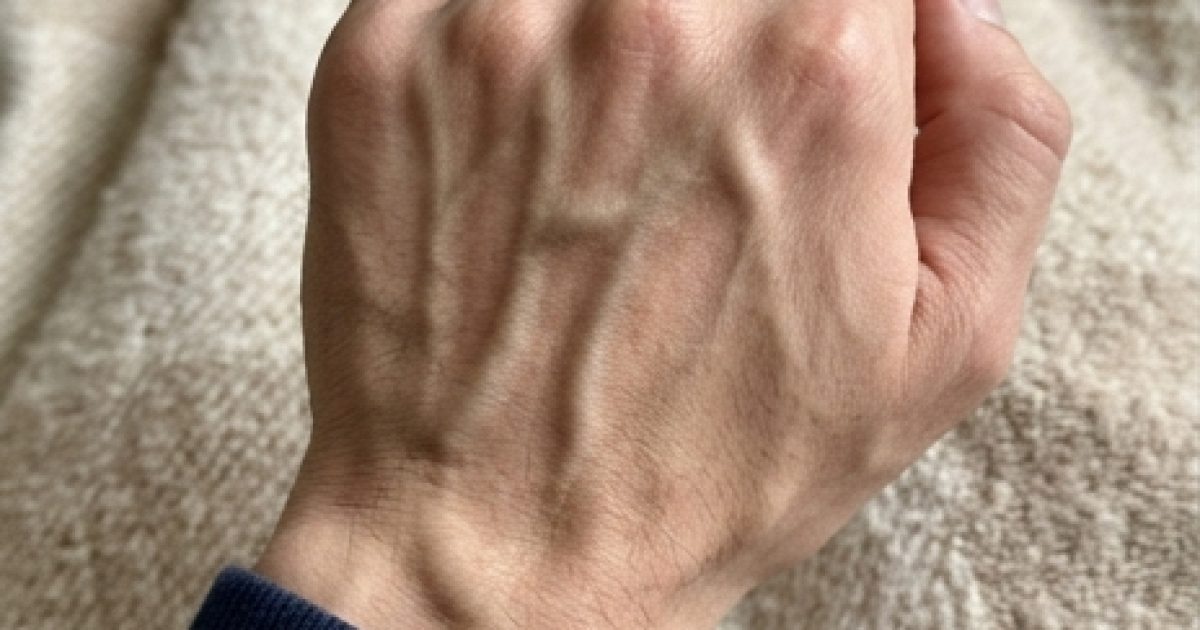 Veines apparentes sur les mains : les vraies explications et quand s'inquiéter