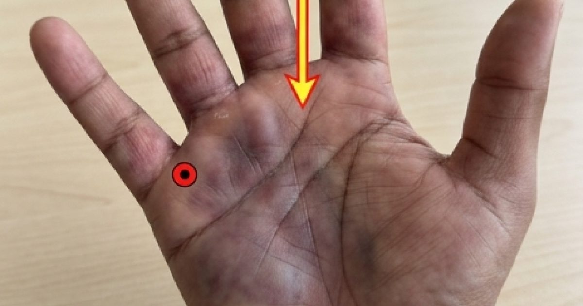 Blessure infectée : 7 signes qui doivent vous alerter et les gestes qui sauvent