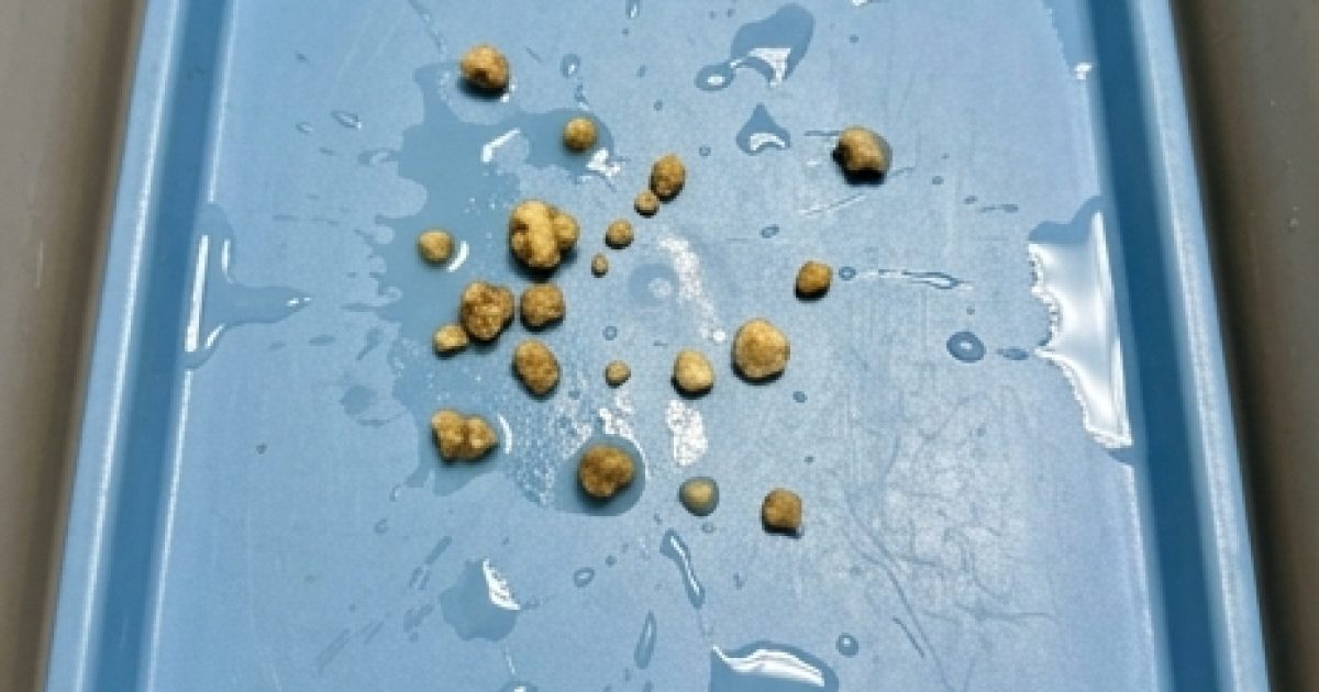 Graines et noix : lesquelles consommer avec précaution au quotidien ?