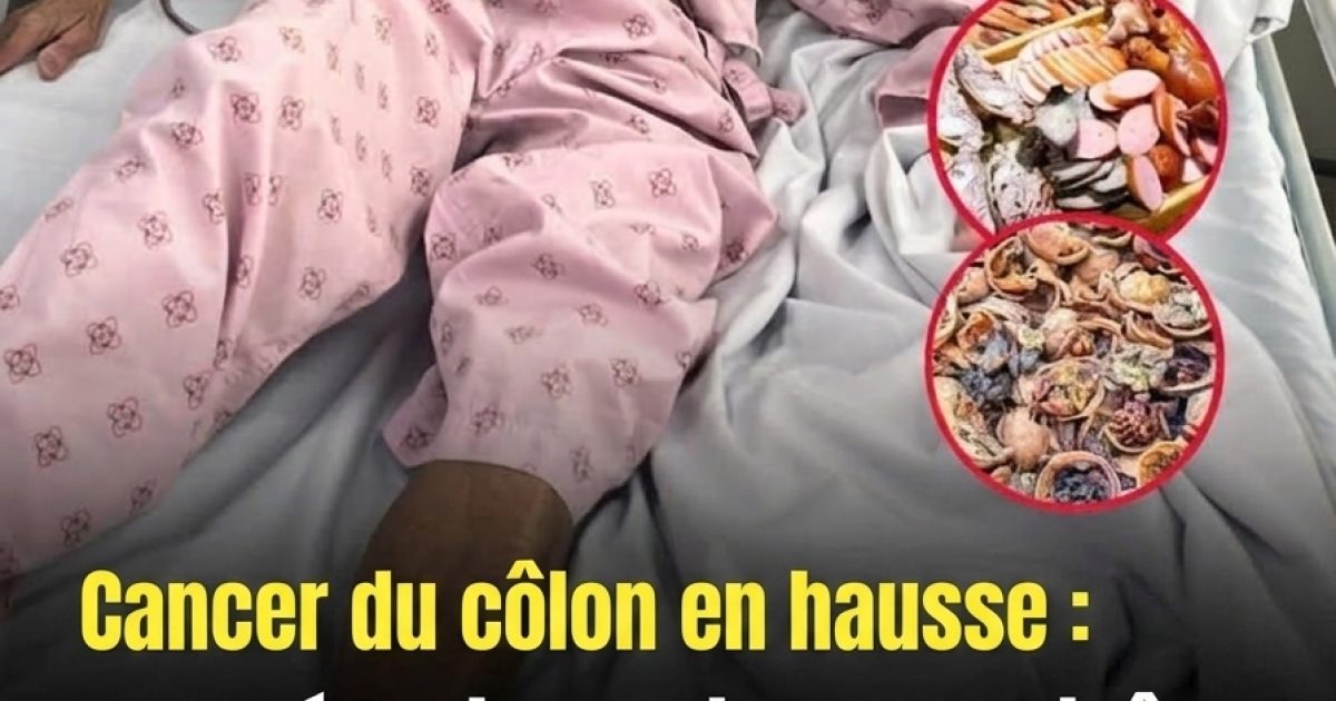 Ces aliments du réfrigérateur qu'il ne faut surtout pas négliger : les risques que vous ignorez