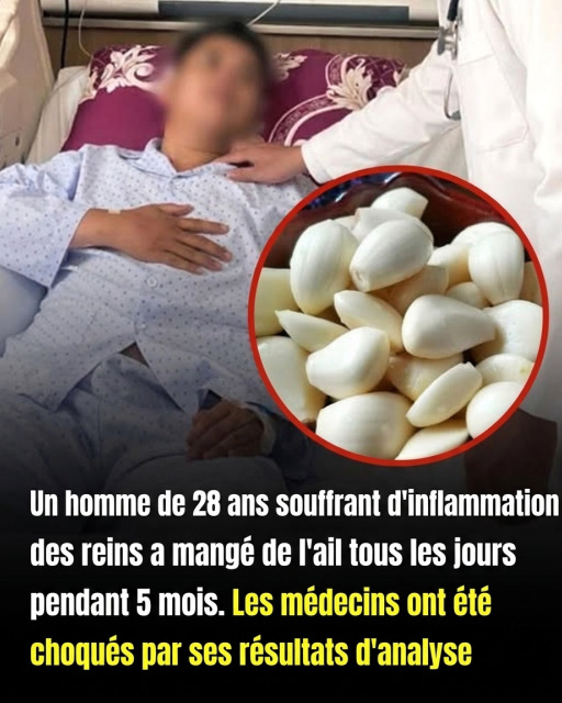 Il mange de l'ail chaque jour pendant 5 mois pour soulager son inflammation rénale : les résultats surprennent les médecins