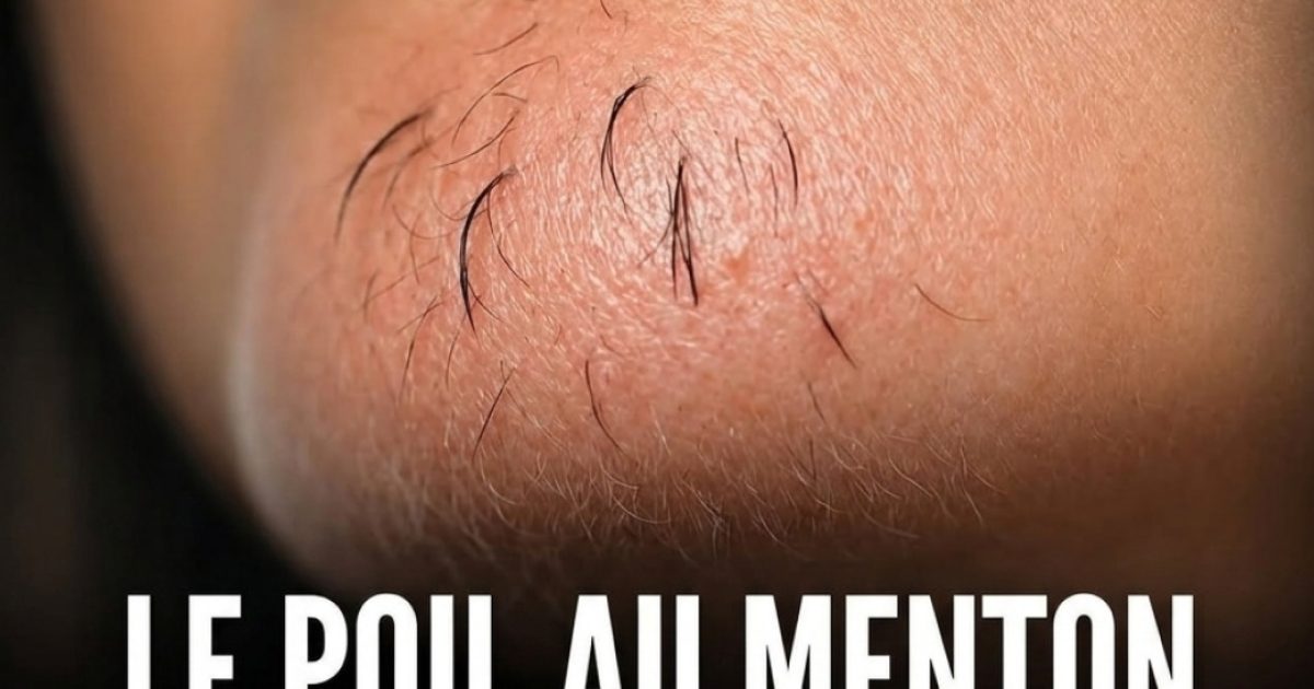 Poils sur le menton chez la femme : pourquoi ça arrive et comment y remédier