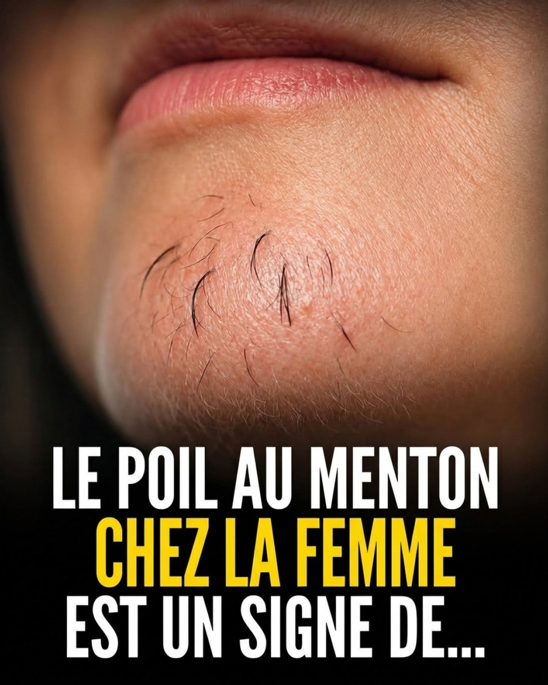 Poils sur le menton chez la femme : pourquoi ça arrive et comment y remédier