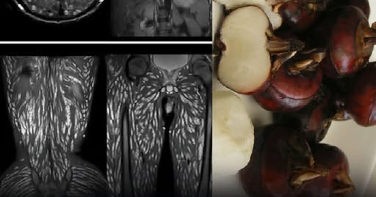 Parasites alimentaires : les aliments à risque et les gestes essentiels pour cuisiner en toute sécurité