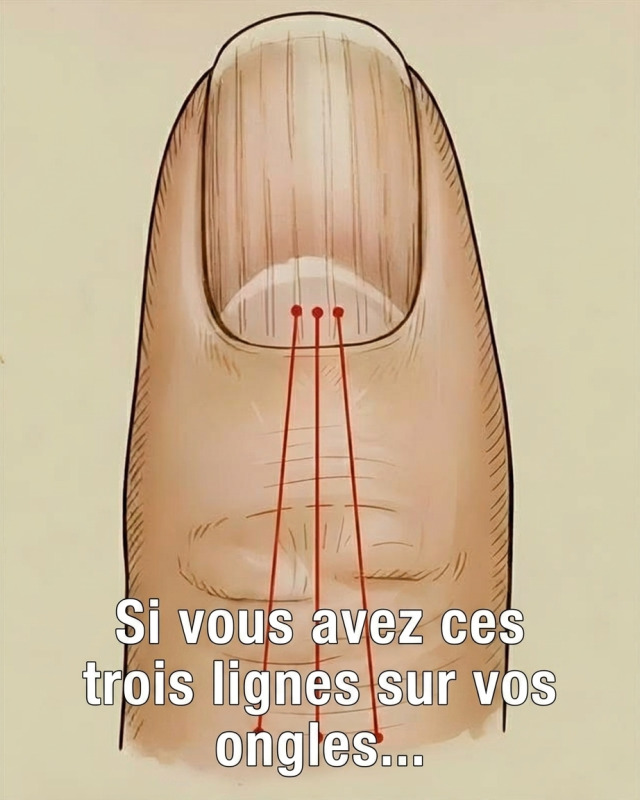 Ce que les stries et la couleur de vos ongles révèlent sur votre santé