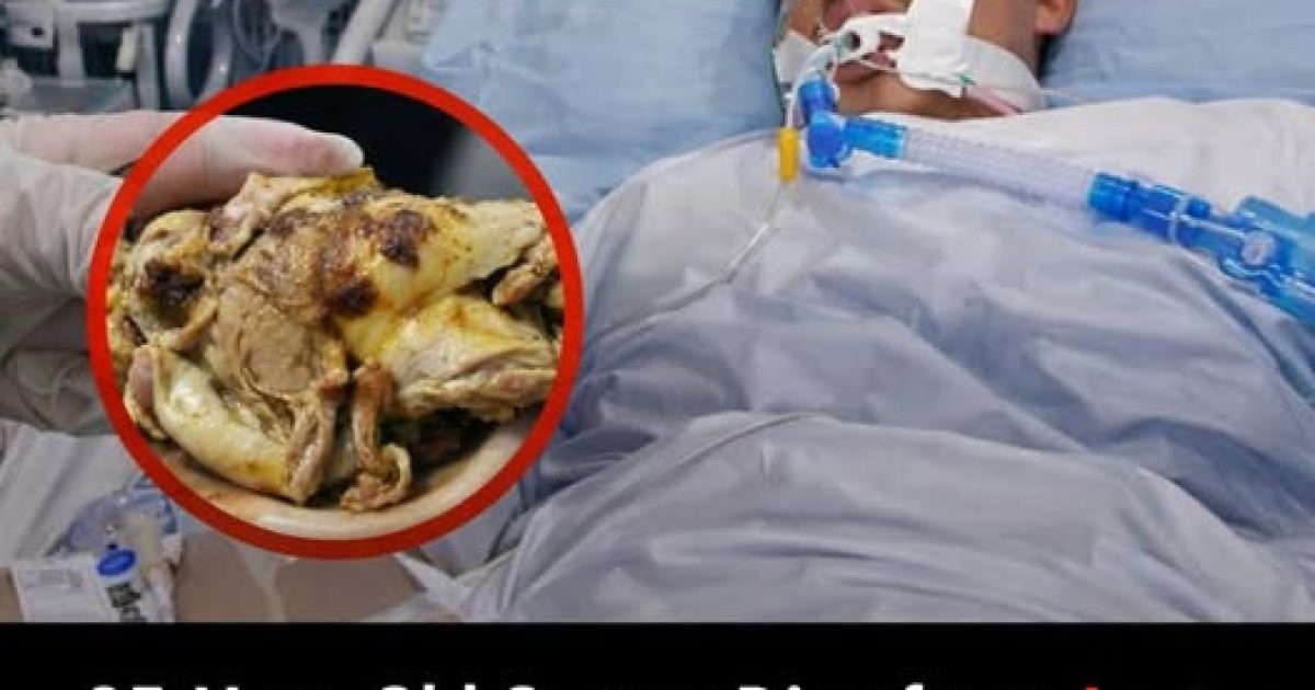 Il décède après avoir mangé du poulet : les règles de sécurité alimentaire qui peuvent vous sauver la vie
