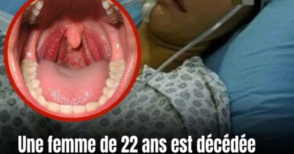 Mal de gorge : 6 signaux d'alarme qui doivent vous faire consulter sans attendre