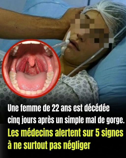 Mal de gorge : 6 signaux d'alarme qui doivent vous faire consulter sans attendre