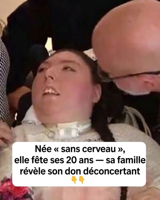 Elle est née sans cerveau et célèbre aujourd'hui ses 20 ans : l'histoire bouleversante d'Alex Simpson