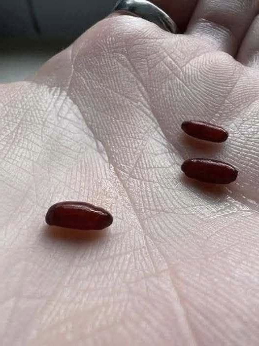 Morsures de tiques : maladies, prévention et bons gestes à connaître absolument