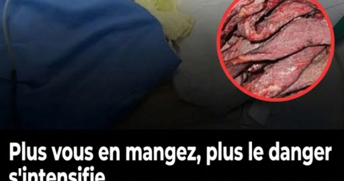Charcuterie : pourquoi en manger trop souvent peut nuire à votre santé