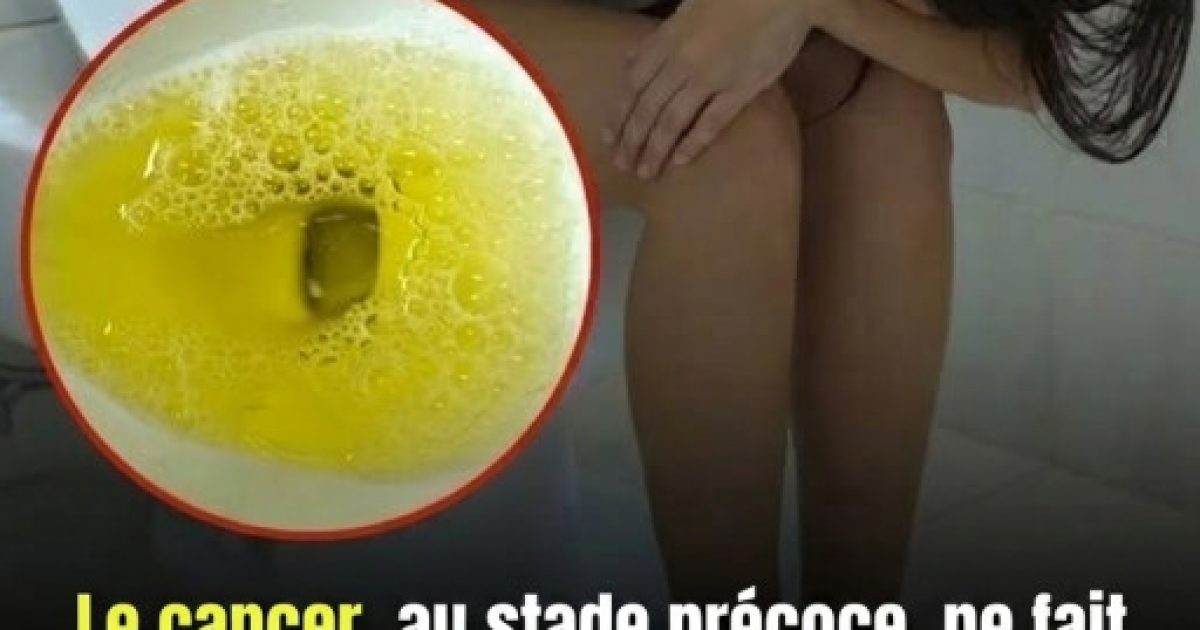 Ces signaux aux toilettes que votre corps utilise pour vous alerter
