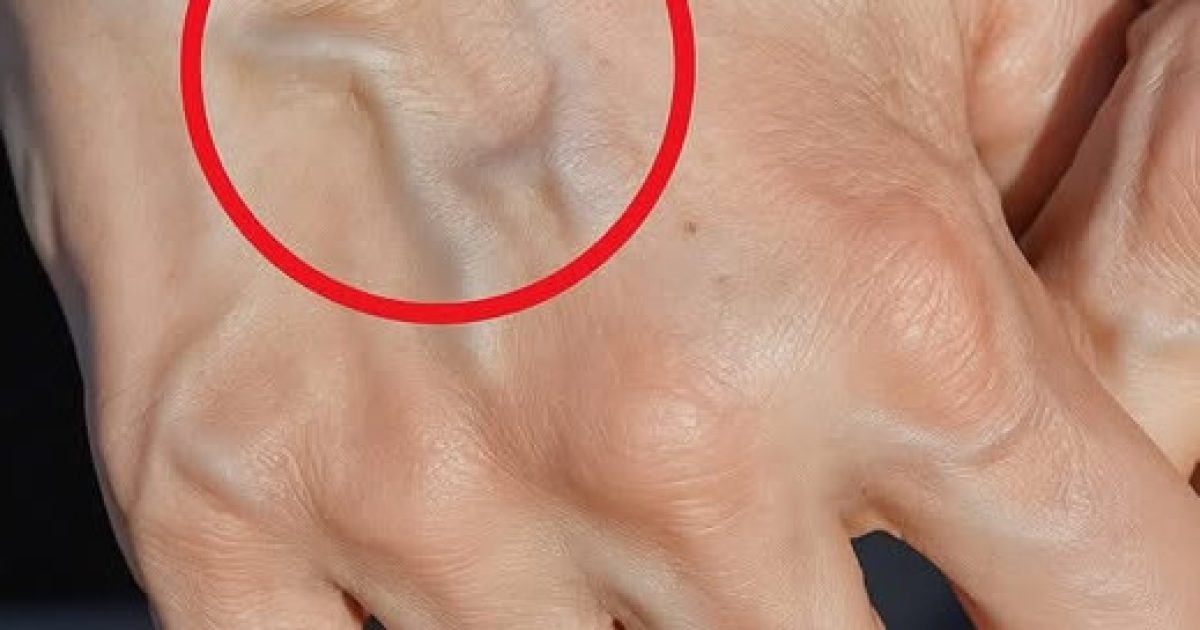 Veines apparentes sur les bras ou les jambes : faut-il vraiment s'inquiéter ?
