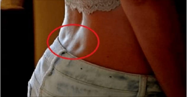 Ces deux petites fossettes dans le bas du dos : que cachent-elles vraiment ?