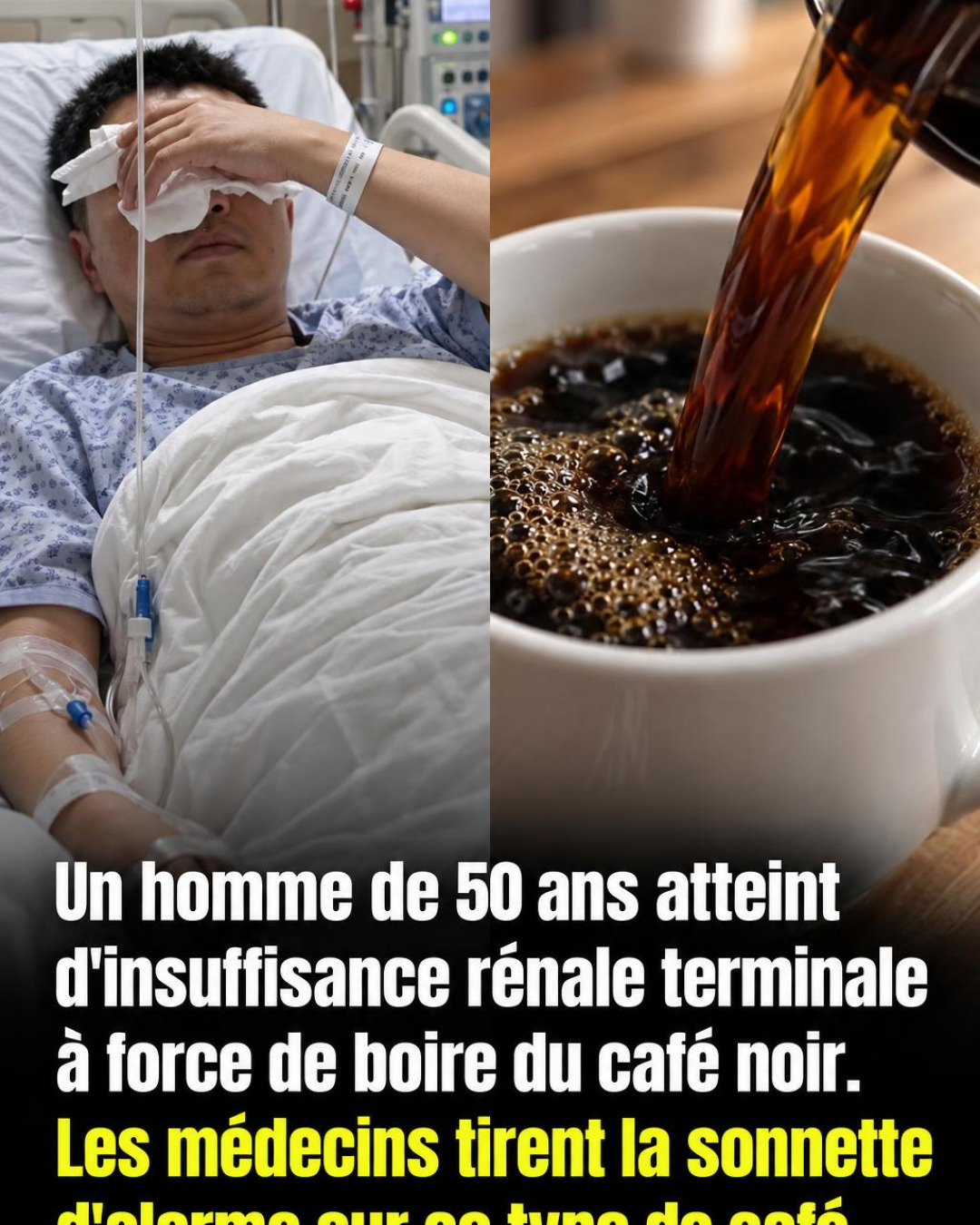 Santé des reins : non, ce n'est pas le café le vrai coupable