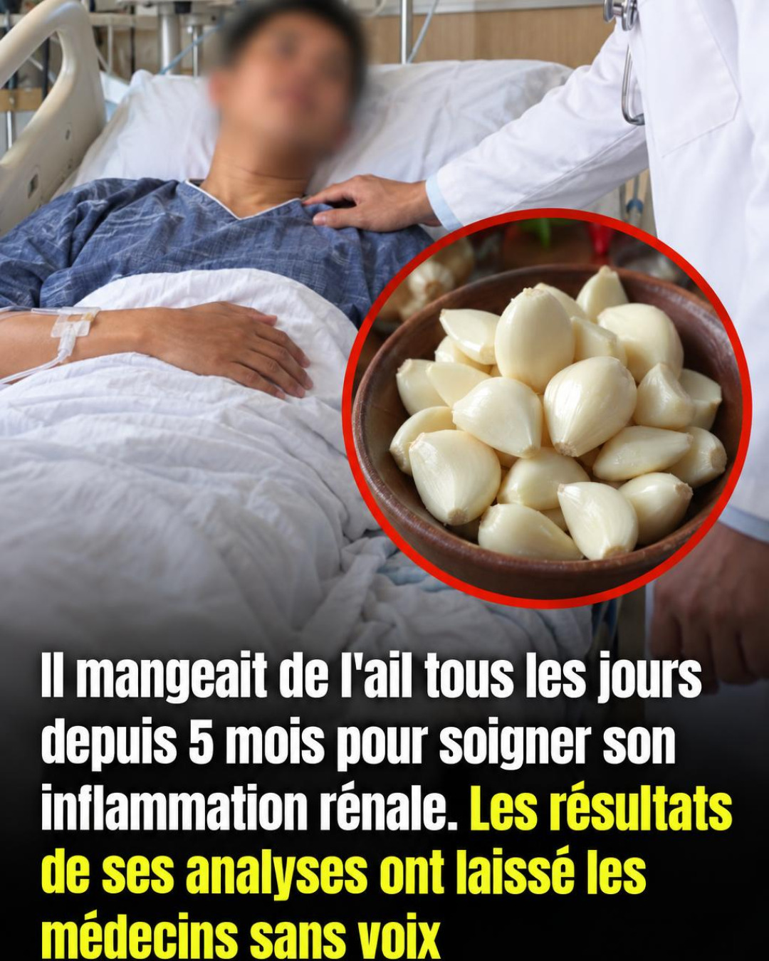 Il intègre de l'ail dans ses repas après un problème aux reins : ce qui s'est passé en 5 mois étonne ses médecins