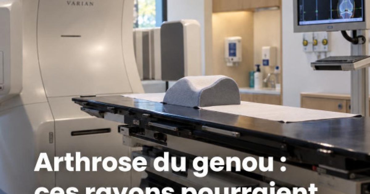 Arthrose du genou : et si la radiothérapie à faible dose changeait vraiment la donne ?