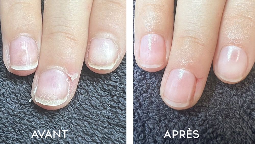 Le duo inattendu vaseline-citron : 5 astuces beauté à essayer d’urgence