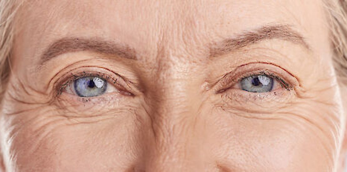 Illustration des changements cutanés après la ménopause