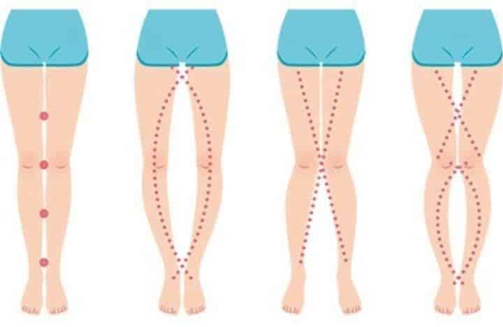 Santé féminine : le message caché que vos jambes envoient sur votre bien-être intime