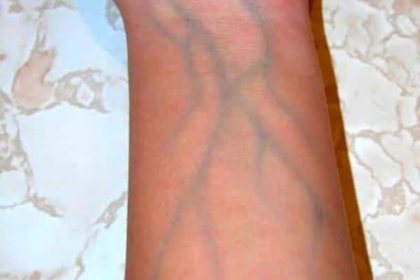 Veines apparentes sur les mains : quand faut-il tirer la sonnette d’alarme ?