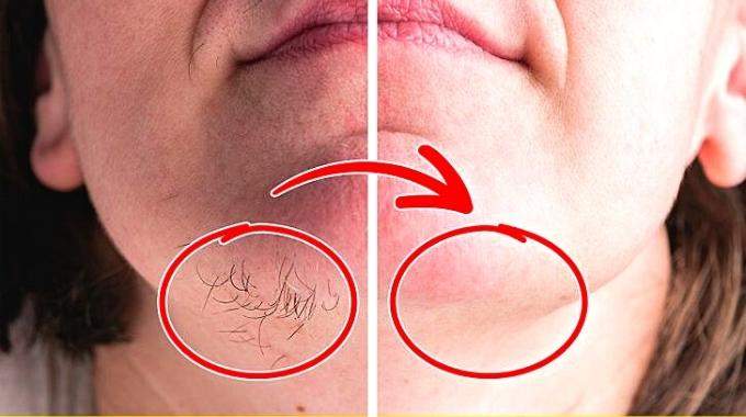 Photo montrant différentes méthodes d'épilation douce pour le visage