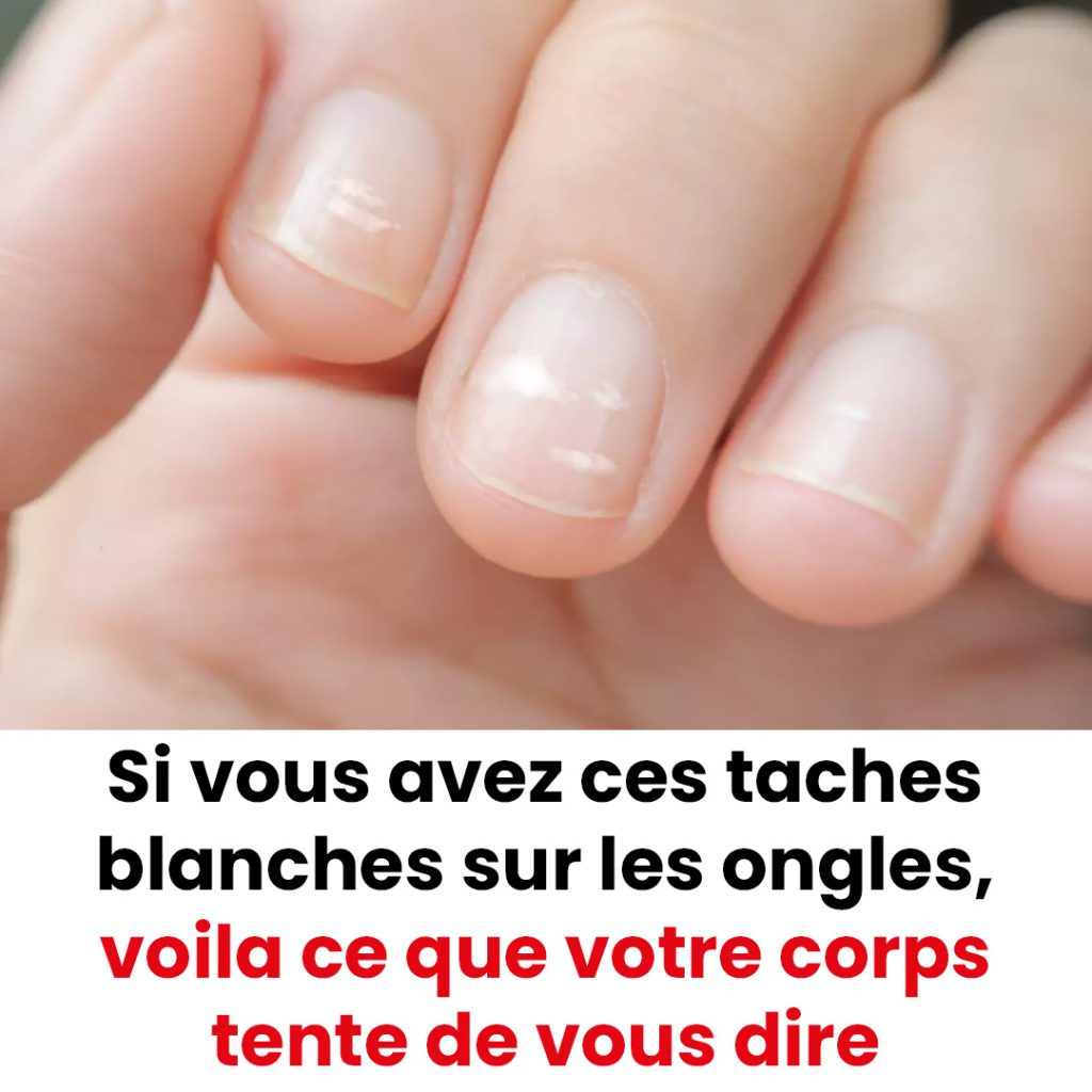 Comprendre ces petites marques blanches qui apparaissent sur vos ongles — free download