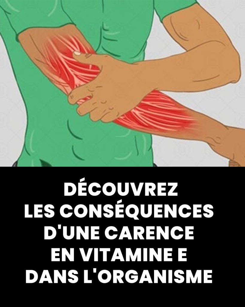 Manque de vitamine E ces signaux corporels à ne pas ignorer — free download