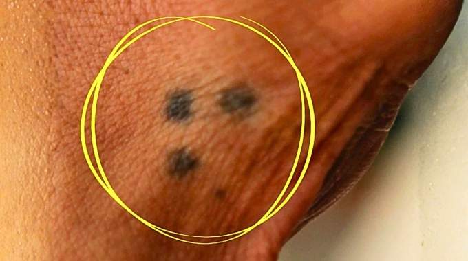 Tatouage à trois points discret sur la main, entre le pouce et l'index