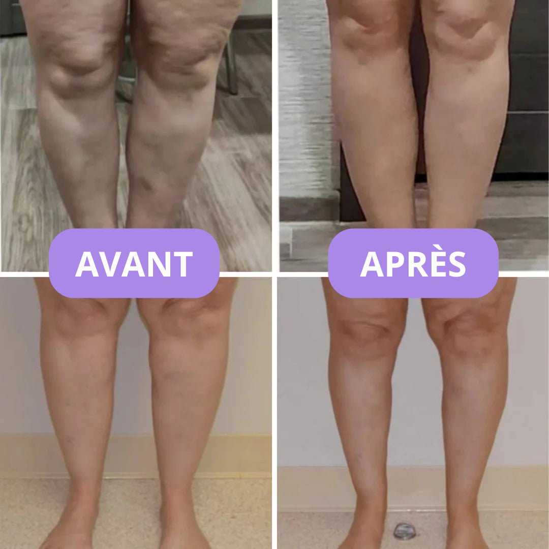 Infusion détox pour jambes légères