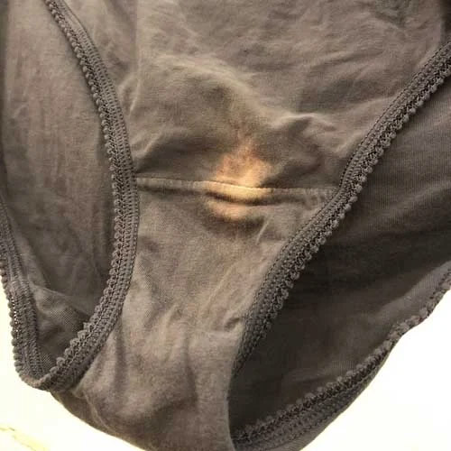Taches blanches sur vos sous-vêtements : ce que votre corps vous dit vraiment