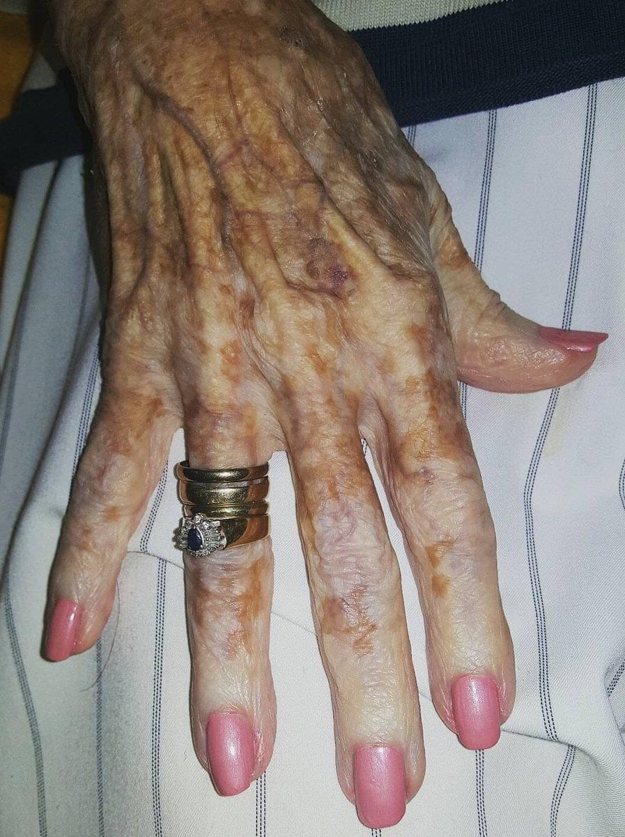 Main d'une personne âgée recevant une manucure attentionnée