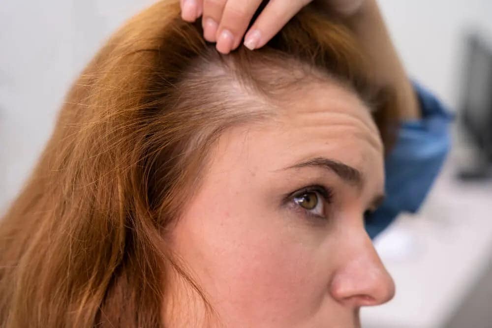 Votre cuir chevelu vous gratte ? On démêle les vraies causes pour vous aider à stopper l’inconfort